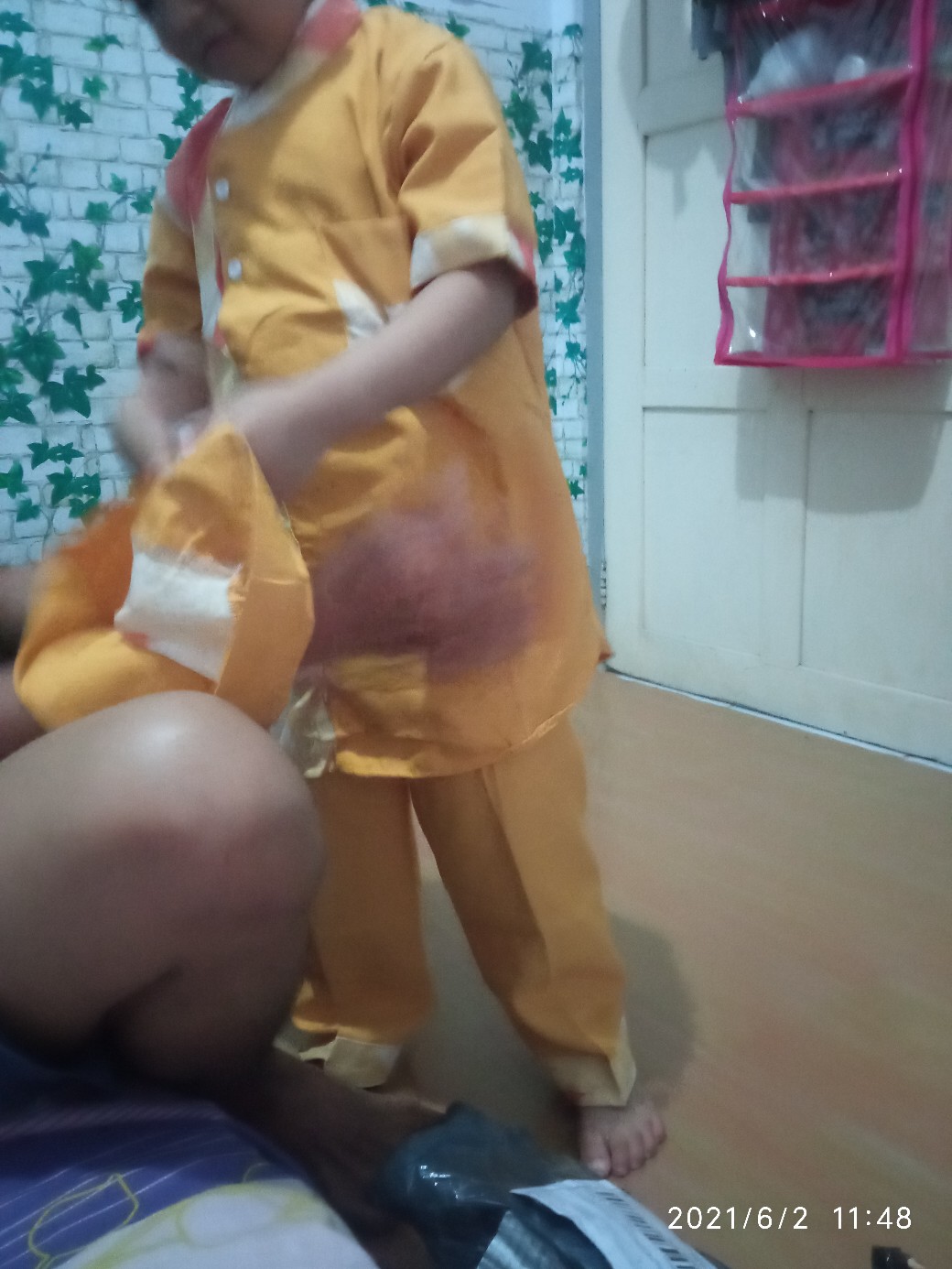 Koko Turki Anak Kombinasi Batik 1-7 Thn