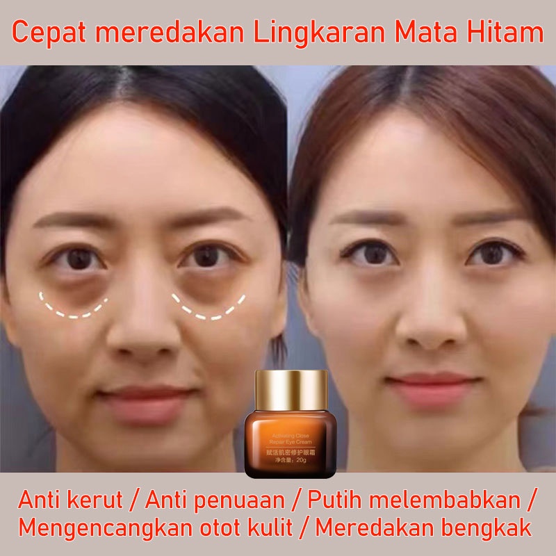 Krim mata Mengencangkan otot kulit Menghilangkan kantong mata Garis halus/Cepat meredakan lingkaran mata hitam Anti kerut Anti penuaan Meredakan bengkak