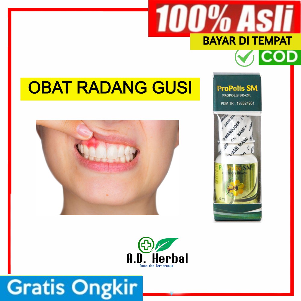 Obat Radang Gusi Sakit Gigi Berlubang Gusi Berdarah Bengkak Dan Sakit Dengan Propolis Shopee Indonesia