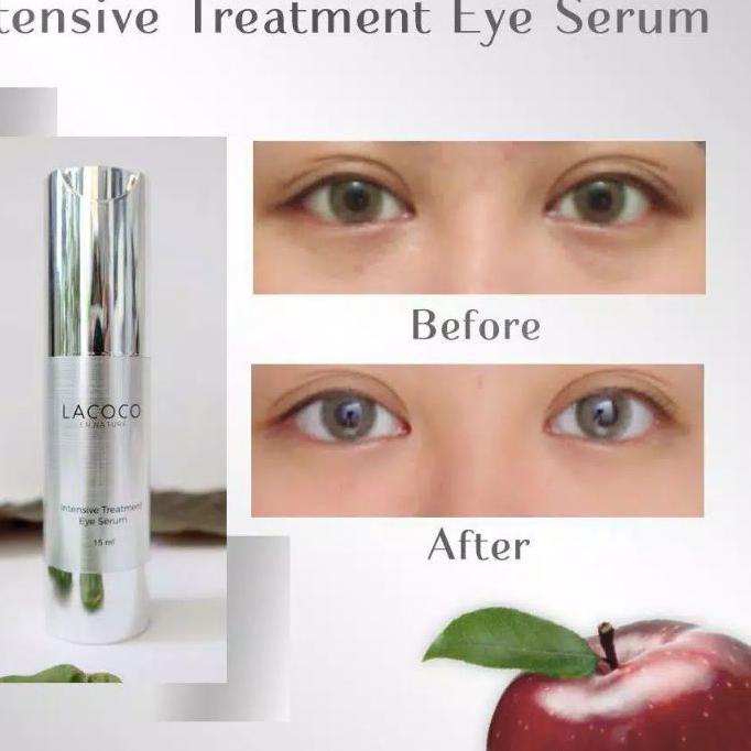 ☈ Lacoco Intensive Treatment Eye Serum MATA PANDA pencerah Kelopak Mata garis ➦