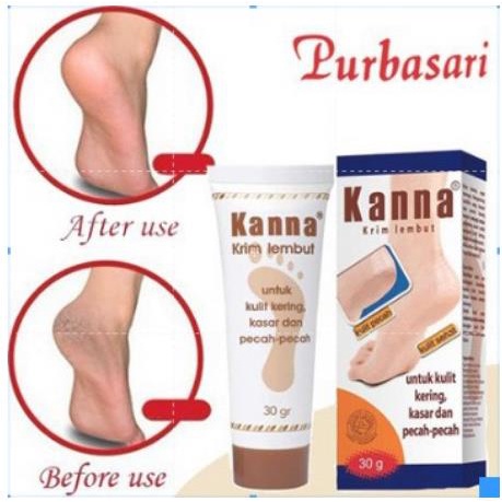 ^ KYRA ^ Kanna Soft Cream Krim Kaki Kana White Foot Cream Untuk Perawatan Tumit Kaki Pecah dan Kulit Sehat