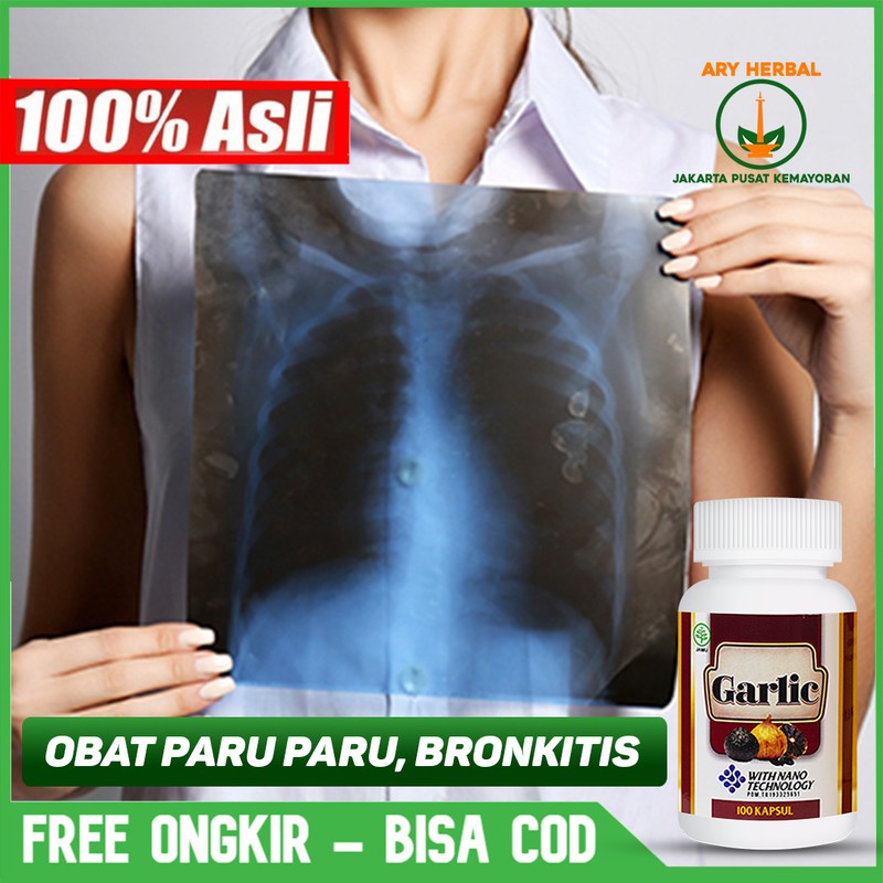 

Obat Paru Paru, Bronkitis, Batuk Berdahak, Sesak Nafas Garlic Kapsul Original Di Jakarta Pusat