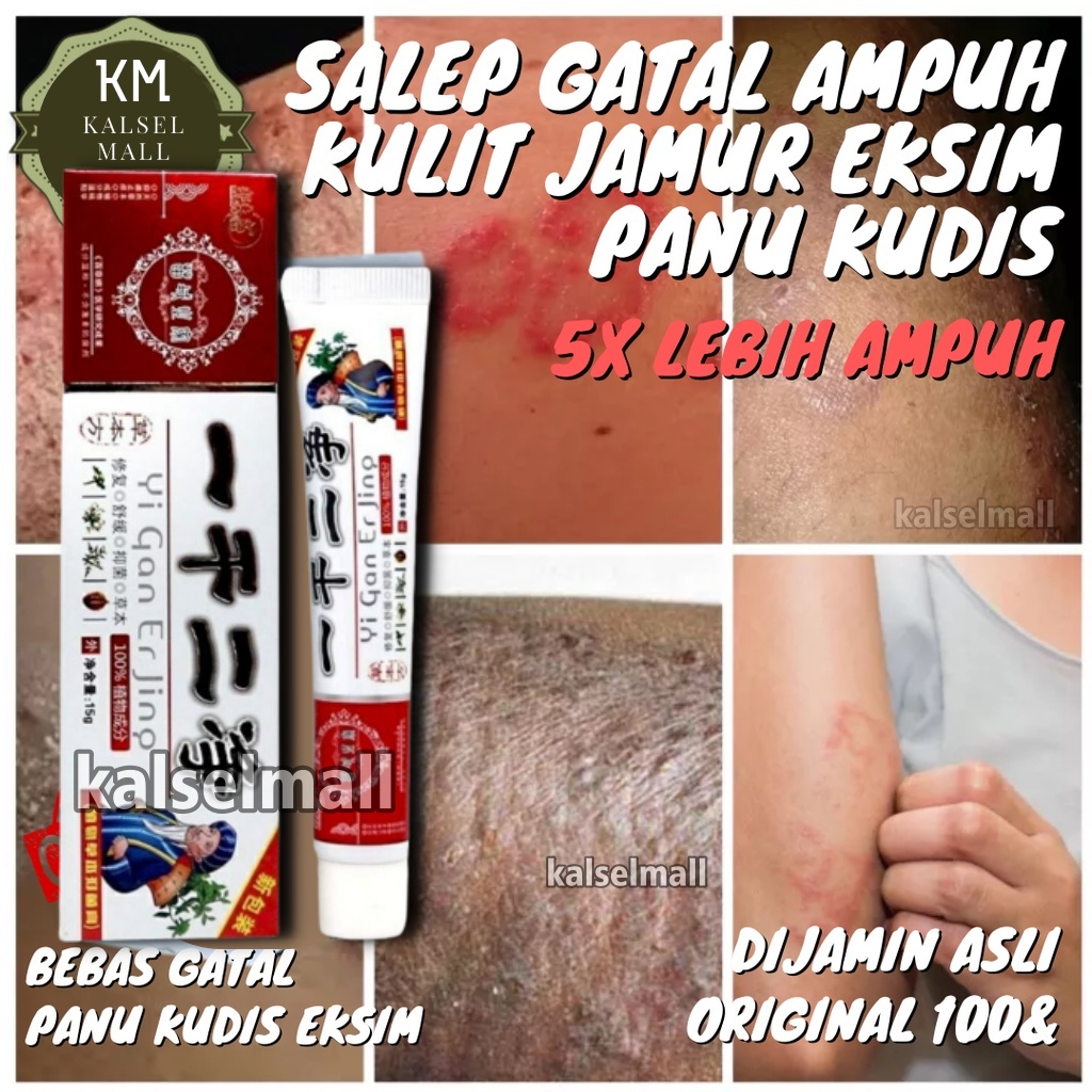 Salep Cream Krim Krem Obat Salap Gatal Yiganerjing ORIGINAL 100% Alergi Jamur Panu Kadas Ruam Eksim Selangkangan Jamuran Jerawat Kudis Korengan Kurap Kutu Air Psoriasis Skabies Panuan Keputihan Cina Herbal Tradisional OC13