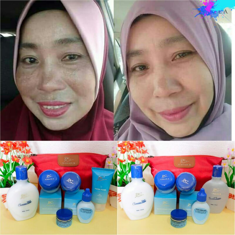 Paket  Flek hitam whitening Skincare SK Supijati K