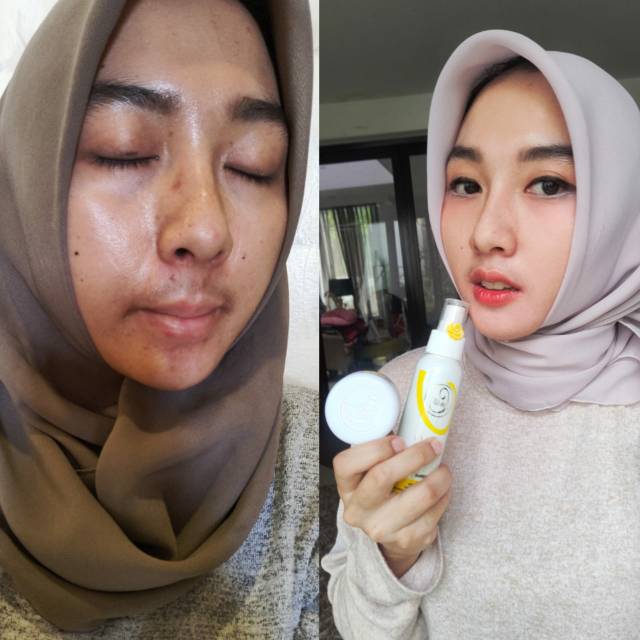 Paket acne Bebwhite C Skincare BPOM