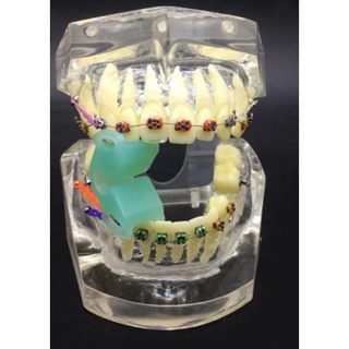 model study ortodonti transparan / dental model study / phantom gigi ortodonti / model studi replika