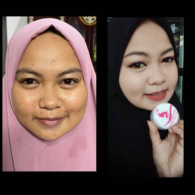 Super whitening DS Skincare