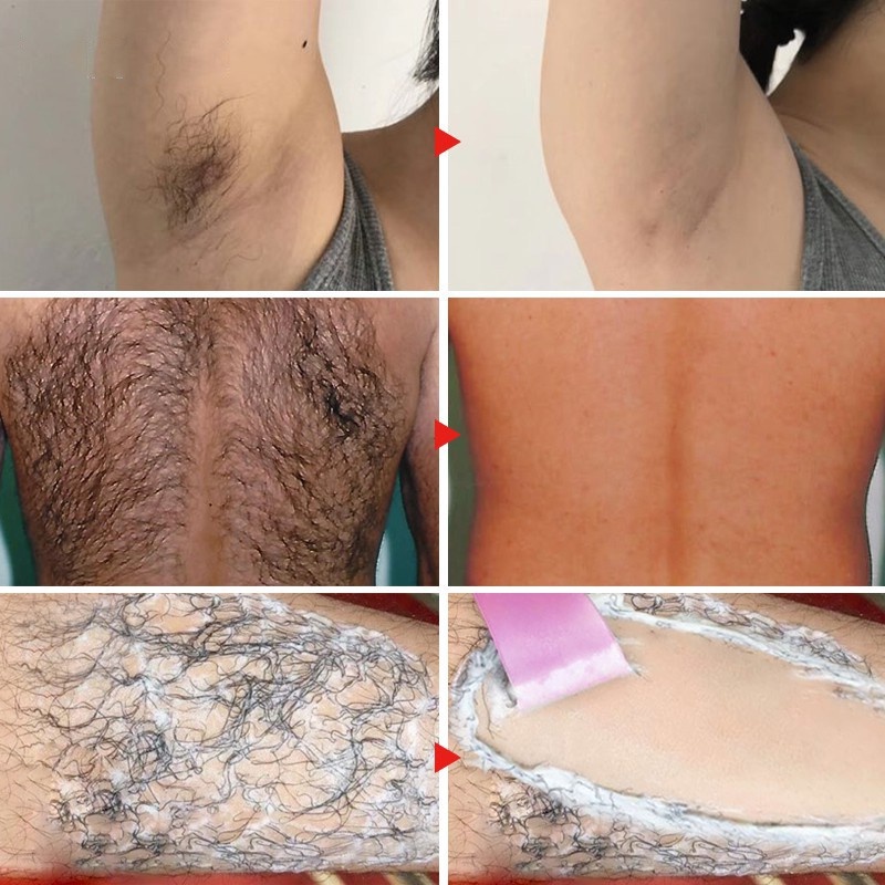 Krim penghilang bulu Spray penghilang bulu Hair ramoval cream Bagian pribadi Ketiak Kaki Hair removal lengan Aman dan sehat Tanpa rasa sakit dan tanpa iritasi