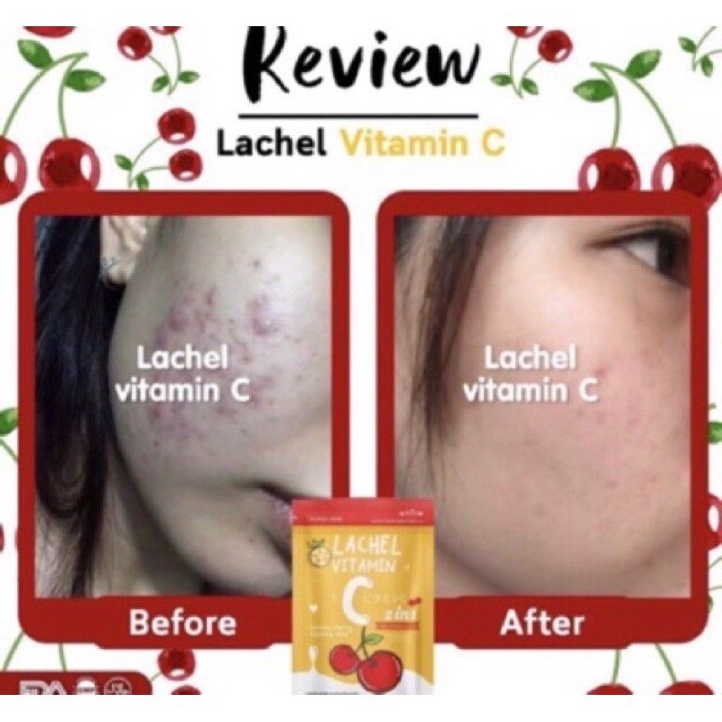 LACHEL VIT C / LACHEL VITAMIN C 100% ORIGINAL THAILAND