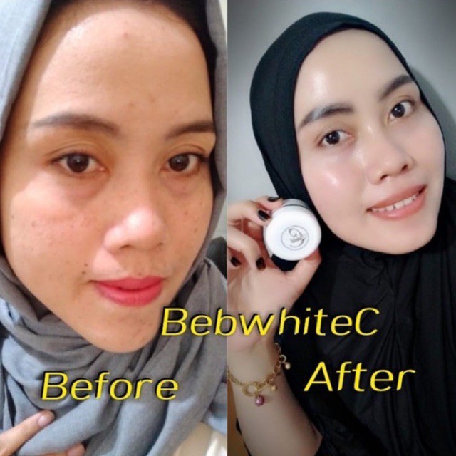 BEBWHITE C SKINCARE ORIGINAL PAKET GLOW / PAKET ACNE / BBC-3