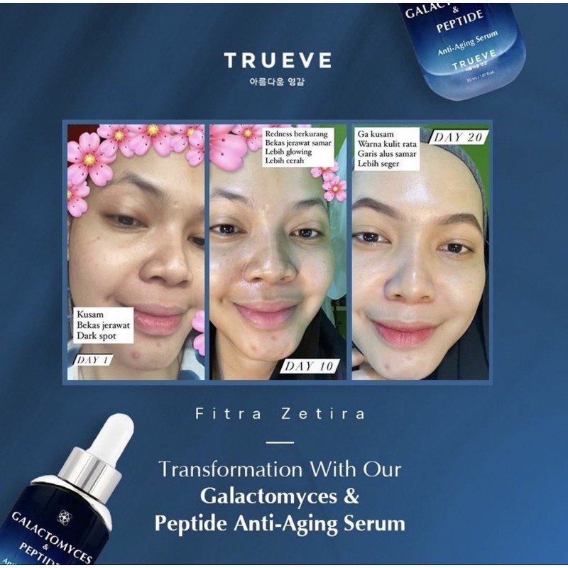 TRUEVE Ultimate Youth Activating Serum (Anti Aging Serum,Pemutih Wajah, Serum Glowing, Flek Hitam)