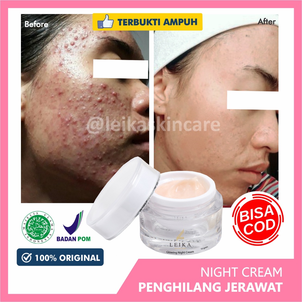 Asli! Penghilang Jerawat dan Bekas Jerawat Pria Wanita Paling Ampuh Permanen Penghilang Jerawat / Jerawat Pasir / Jerawat Batu / Bruntusan  - Leika Skincare Glowing Night Cream 100% Resmi BPOM Halal