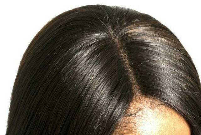 Hair Toupee clousure penutup botak wanita human hair