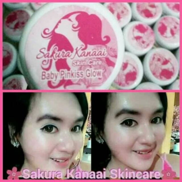 

Babypinkis