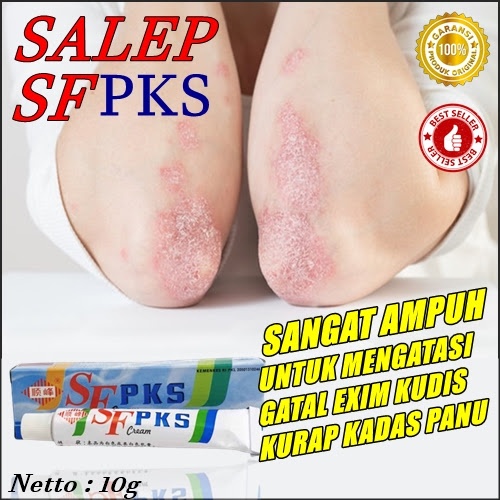 TERBARU sf pks cream pi kang suang salep obat gatal herpes eksim dan kutu air di badan aman alami am