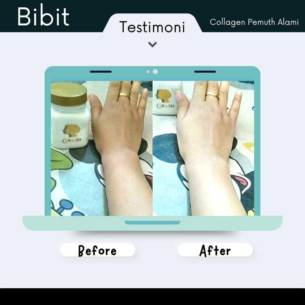 Bibit Pemutih Collagen - Handbody Lotion Pemutih Kulit Luluran Pemutih Badan Cream Glowing Permanen Bibit Collagen Shcosmetic 150ml Ori Bpom