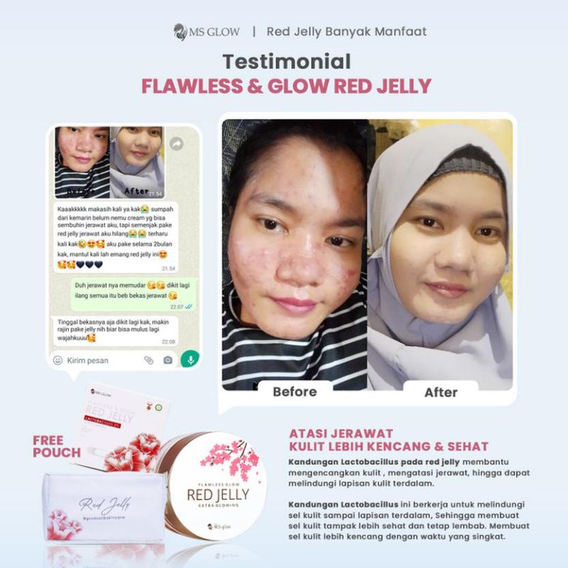 Paket Acne + Red Jelly Lactobacillus || MS GLOW