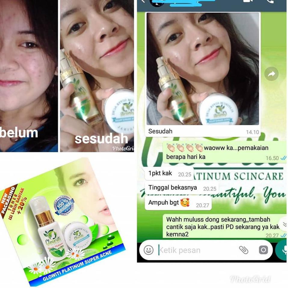 glowiti platinum super acne