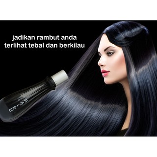  Vitamin  Rambut  Ampuh  Mengatasi Rambut  Rontok  Shopee 