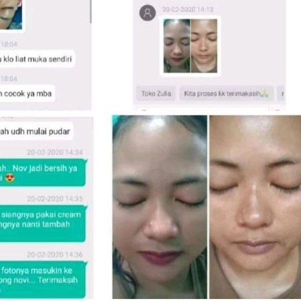 Flek dr Liz / Lis night Cream / Liz night whitening / saleb flek Lis skincare