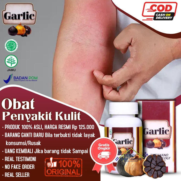 Jual Walatra Black Garlic Obat Kurap Infeksi Jamur Kulit Penyakit Kulit Dermatitis