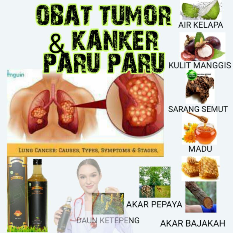OBAT HERBAL TUMOR DAN  KANKER / KANGKER PARU PARU