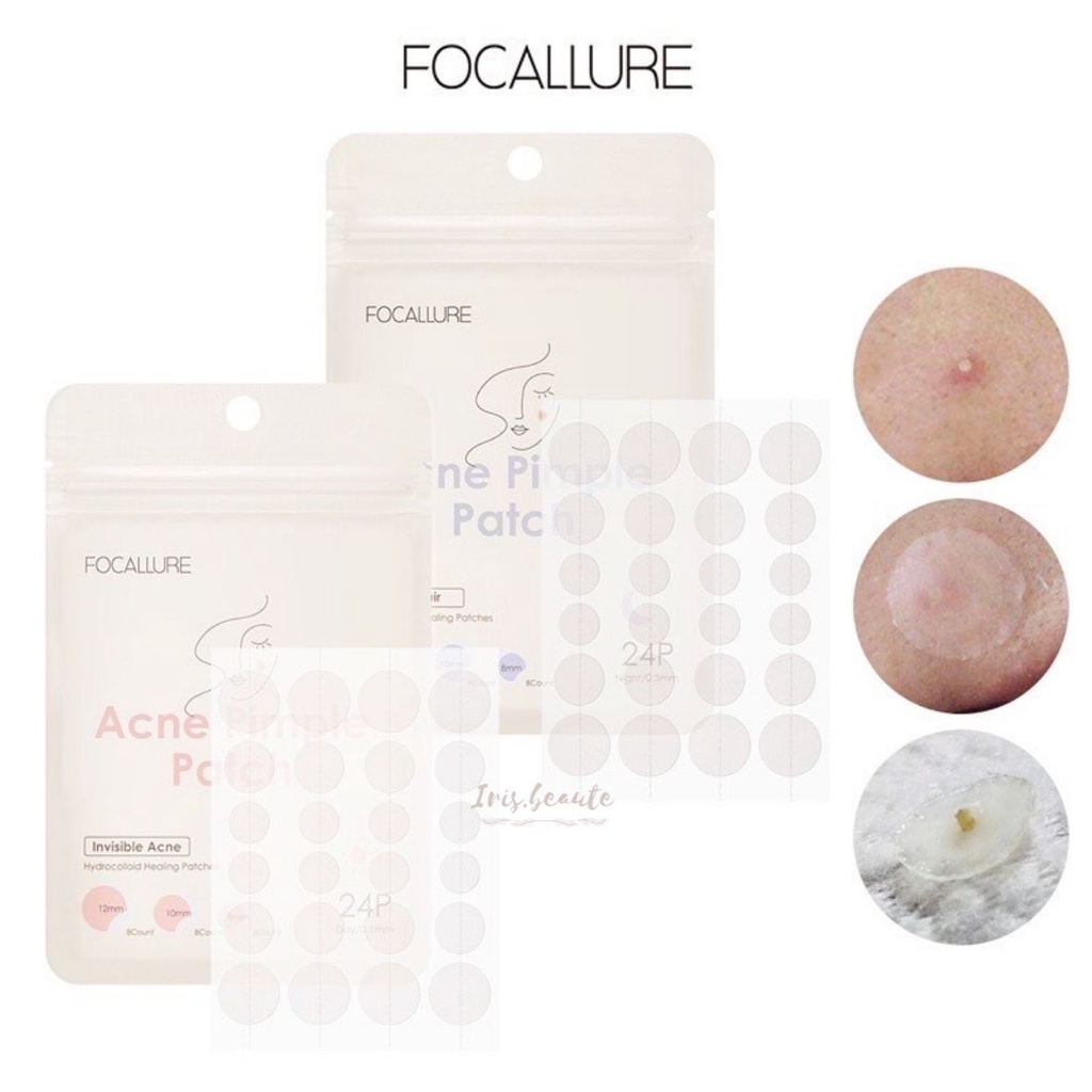 FOCALLURE Acne Pimple Patch Day &amp; Night / Spot Patch Acne Treatment Day/Night