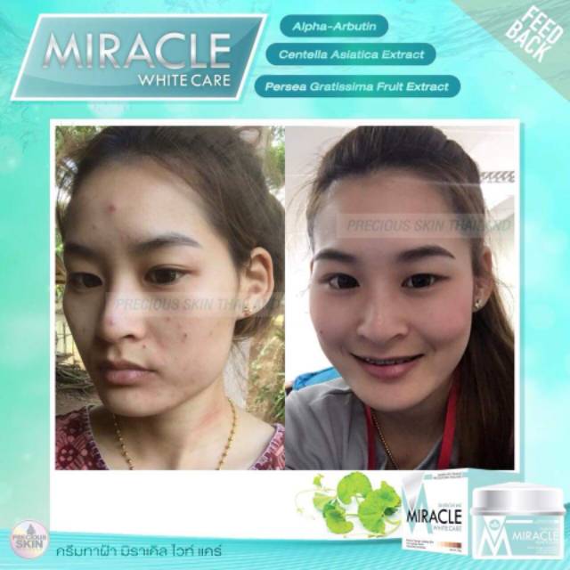 MIRACLE INSTENSIF WHITE CARE CREAM MUKA / KRIM WAJAH / KRIM MUKA / PEMUTIH WAJAH / PERAWATAN WAJAH