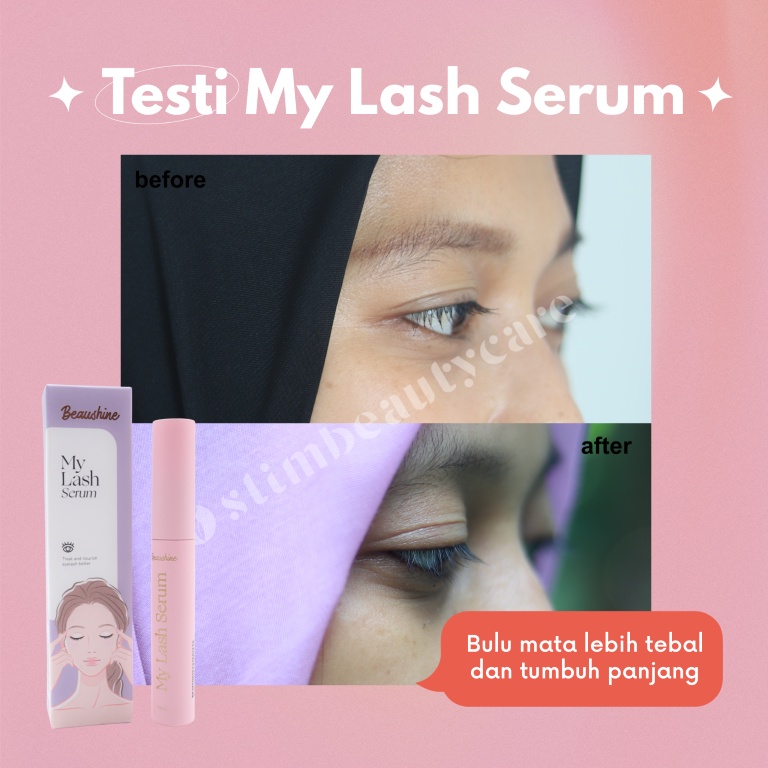 MY LASH SERUM (EYELASH/BULU MATA SERUM, MENEBALKAN BULU MATA &amp; ALIS)