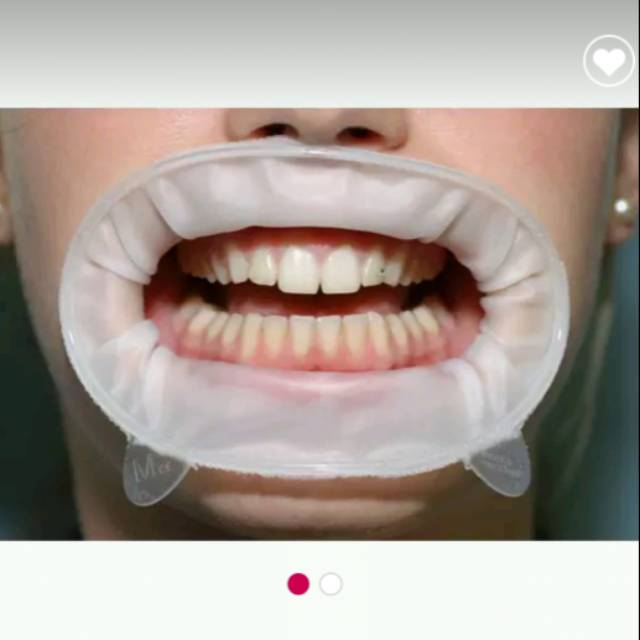 BEHELLDENTAL OPTRAGATE / RUBBER MOUTH OPENER CHEEK RETRACTOR KARET /MOUTHGATE GAG GATE PEMBUKA MULUT