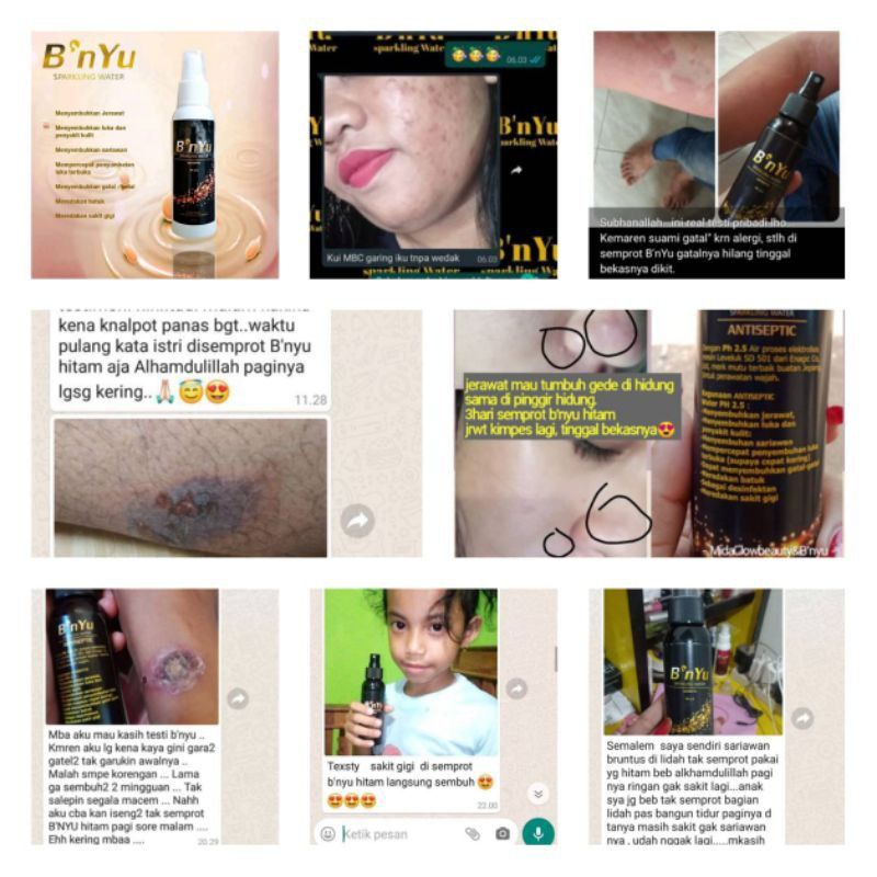 B'nyu Sparkling water beauty acid water | &quot;Air ajaib&quot; dg sejuta manfaat | Bnyu hitam (antiseptik)