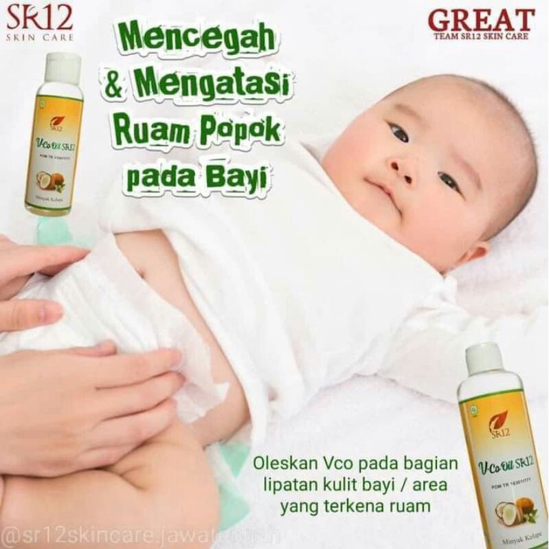 Obat ampuh untuk Ruam popok bayi ,Ruam pipi , leher merah pada bayi ,biang keringat bayi herbal SR12