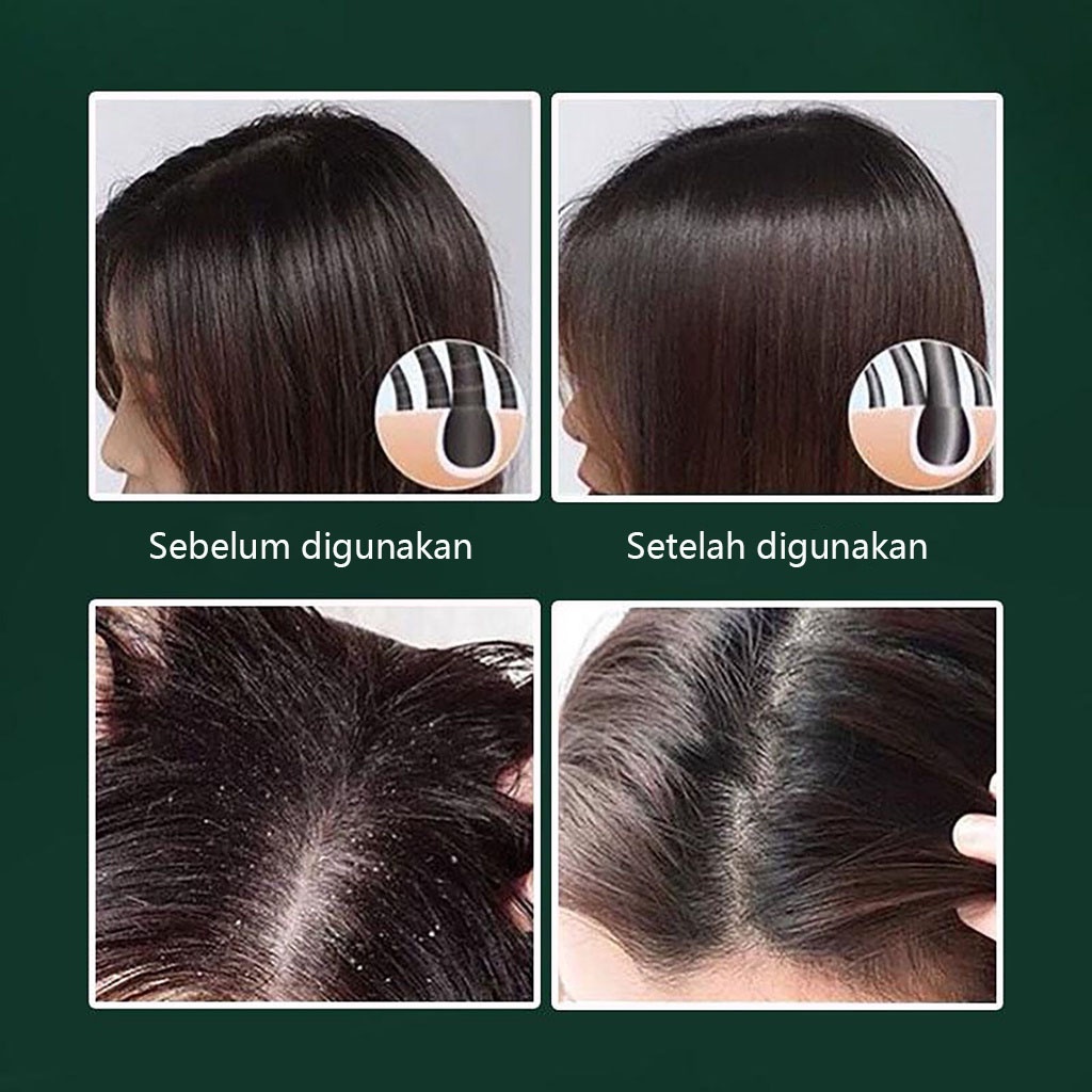 sampo pemanjang rambut sampo kutu sampo rambut 200g ekstrak herbal untuk membersihkan kulit kepala secara mendalam dan mengatasi masalah rambut berminyak dari akarnya