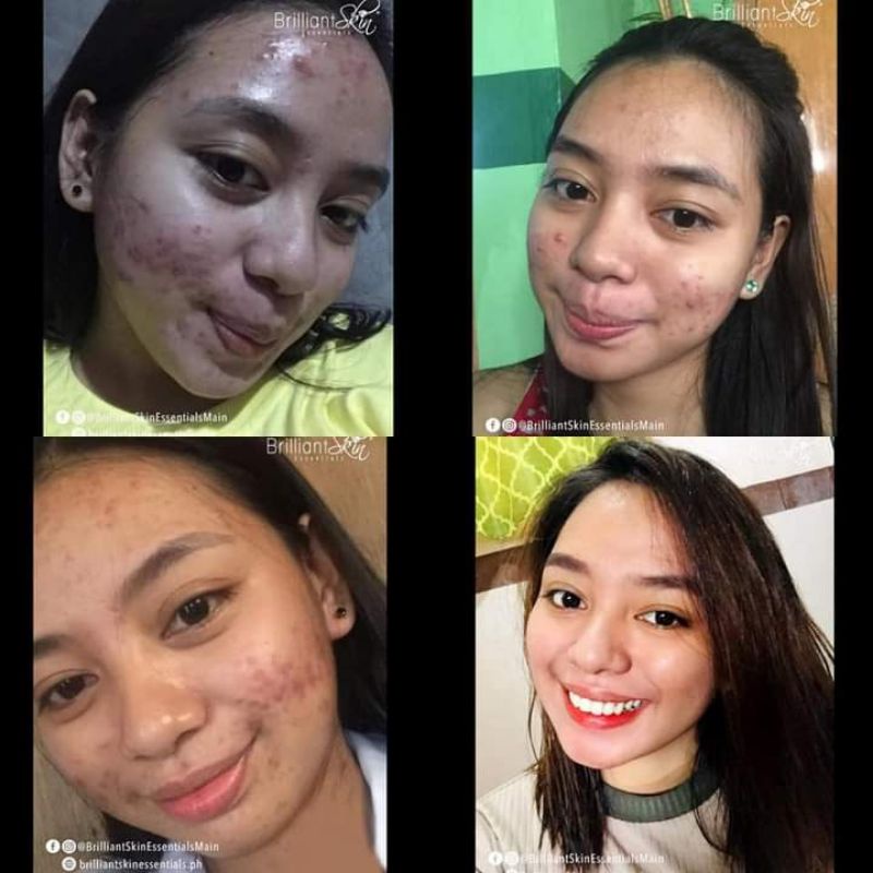 Brilliant Skincare Testimoni Shopee Indonesia