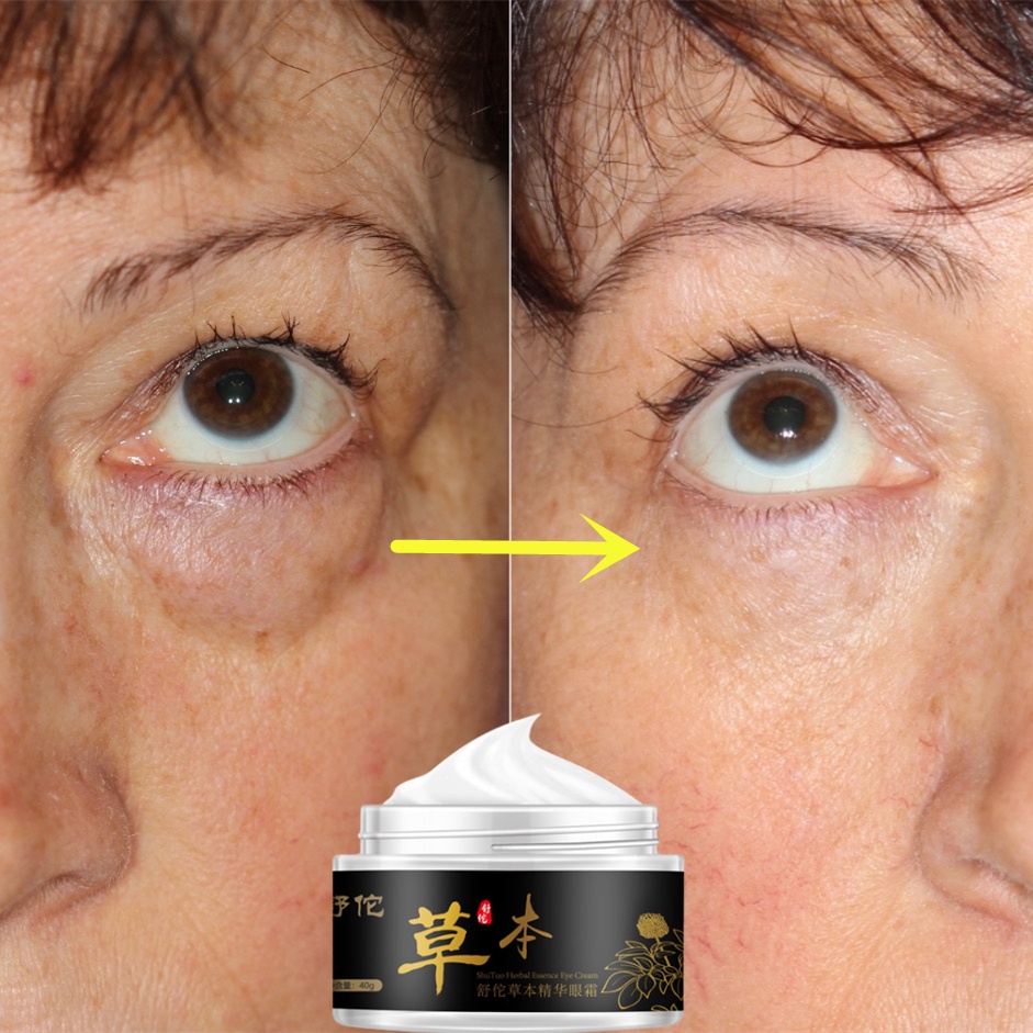 Krim Mata Mata Cerah Lifting Firming Perbaikan Mata Encer Mata Panda Garis Halus Mata Essence