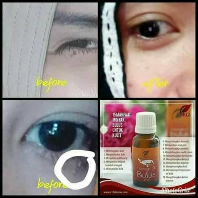 Best Seller Massage Oil Bulus Sr12 Minyak Bulus Sr12 Shopee Indonesia