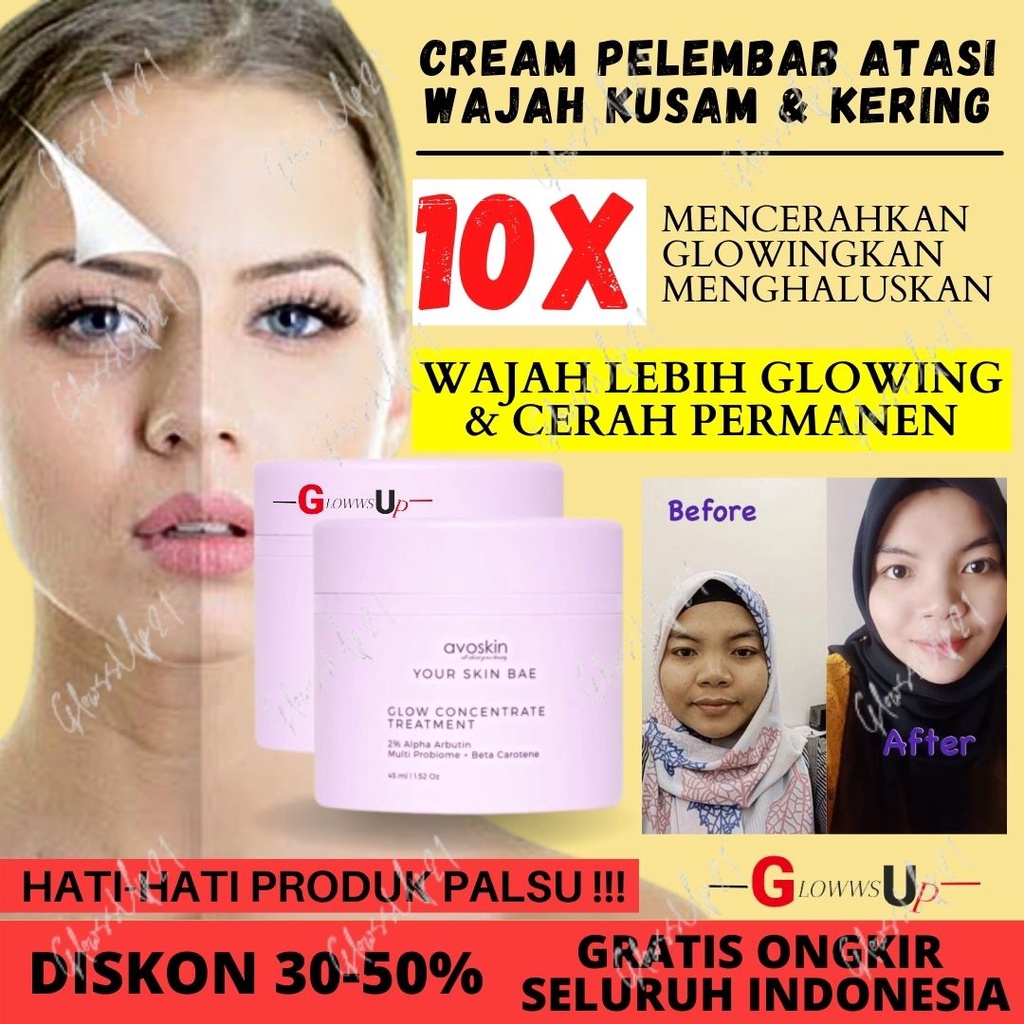 Pelembab Wajah Avoskin YSB Glow Concentrate 2% Alpha Arbutin+Microbiome+Beta Carotene Treatment Wajah