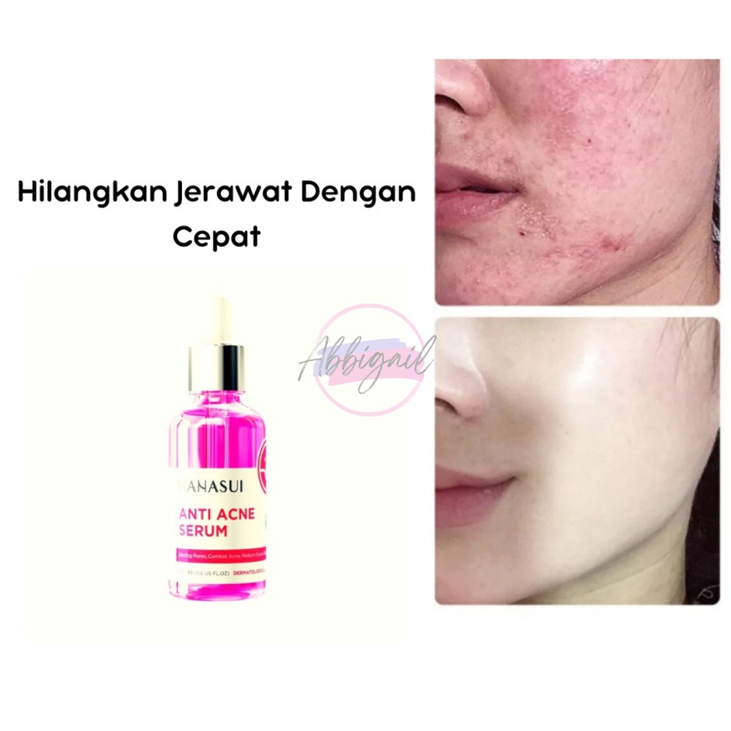 𝘈𝘉𝘎✰  Hanasui Serum / Whitening Gold Vit C Collagen Anti Acne Propolis Men Bright Active / Serum Wajah / Serum Muka / Serum Hanasui / Serum Jerawat / Perawatan Wajah / Serum Garnier 15 ML 2015