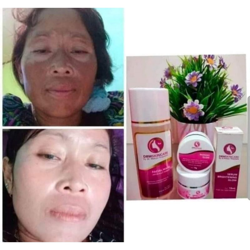 Paket Radiant Brightening Drw skincare/Cream Flek/Cream gLowing