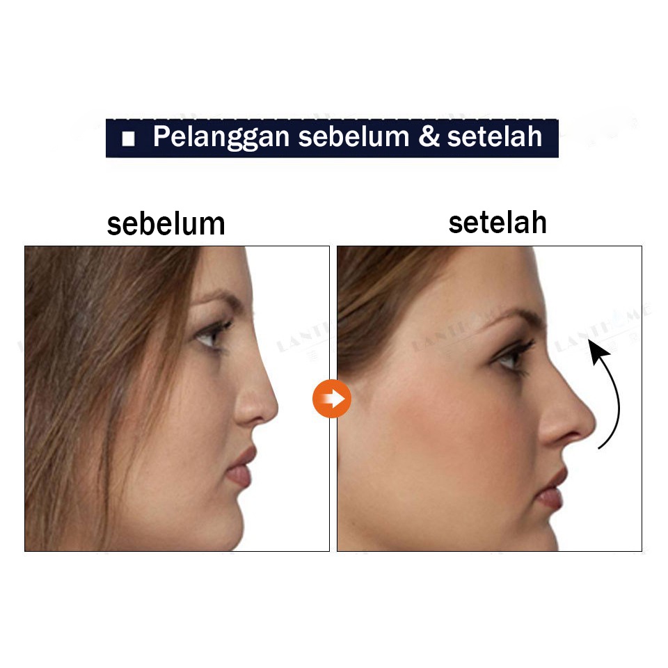 Minyak Pemancung Hidung Pemancung Hidung Esensi Pemancung Hidung 10g Minyak Tanaman Artefak Alami Yang Bantu Tumbuh Cepat Krim Pemancung Hidung