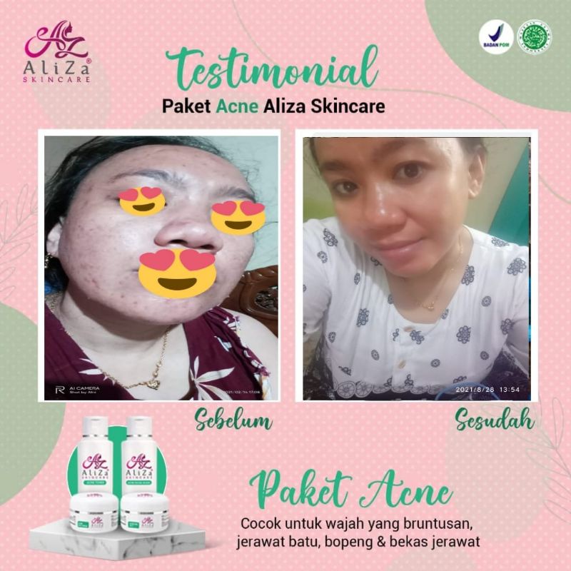 aliza skincare