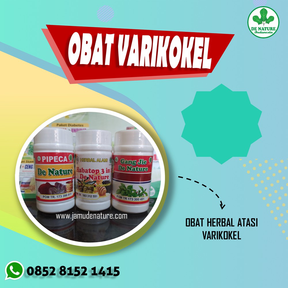 Obat Varikokel Asli De Nature Indonesia