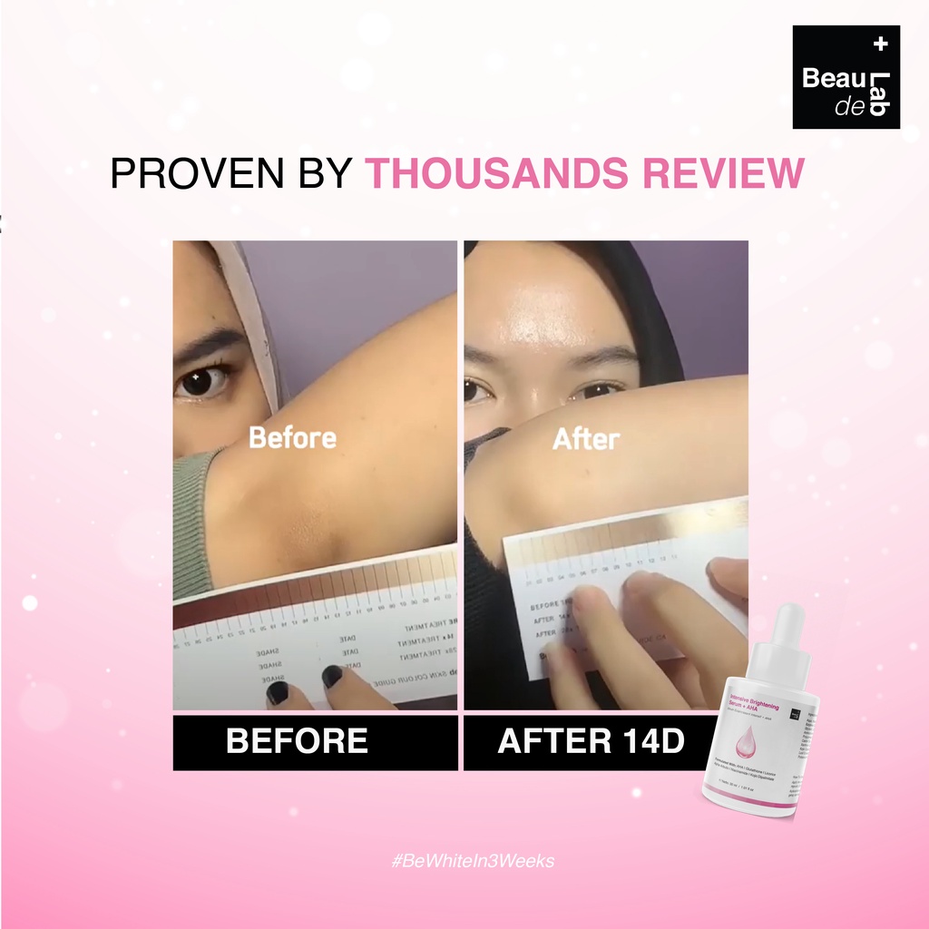 Beaudelab Underarm Brightening Serum AHA | Pemutih Ketiak Selangkangan Instan Cepat| Penghilang Bekas Luka-2