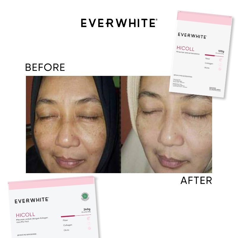 ever white hi collagen drink 1 sachet