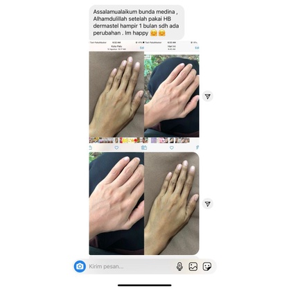 DERMASTELL BRIGHTENING BODY LOTION(COD)