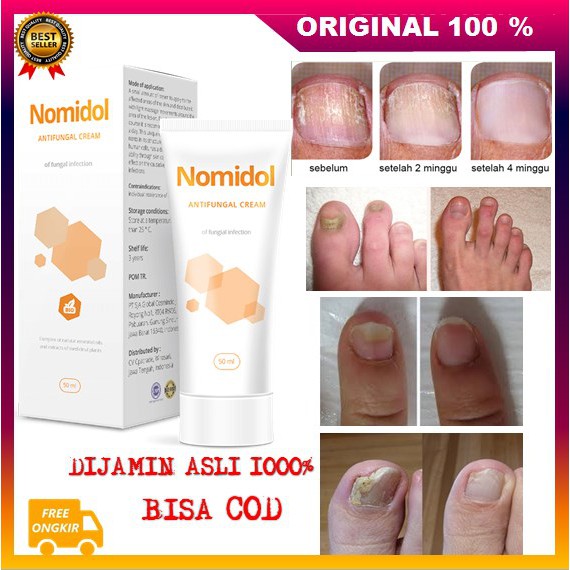 [BISA COD] Obat Jamur Kuku Nomidol Cream Atasi Jamur Kaki dan Kuku ASLI