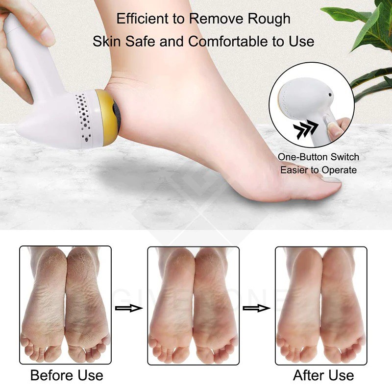 Alat Perawatan Telapak Kaki Elektrik Pedicure Foot Care Tool - HF2021 - White/Gold