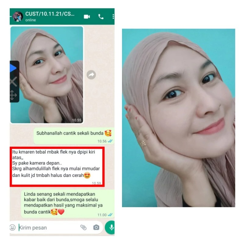 2 BOTOL VAS COLLAGEN bonus 2 VAS SERUM Vas collagen gamat emas colagen original 100% asli ori penghilang flek hitam membandel di wajah ampuh bpom alami