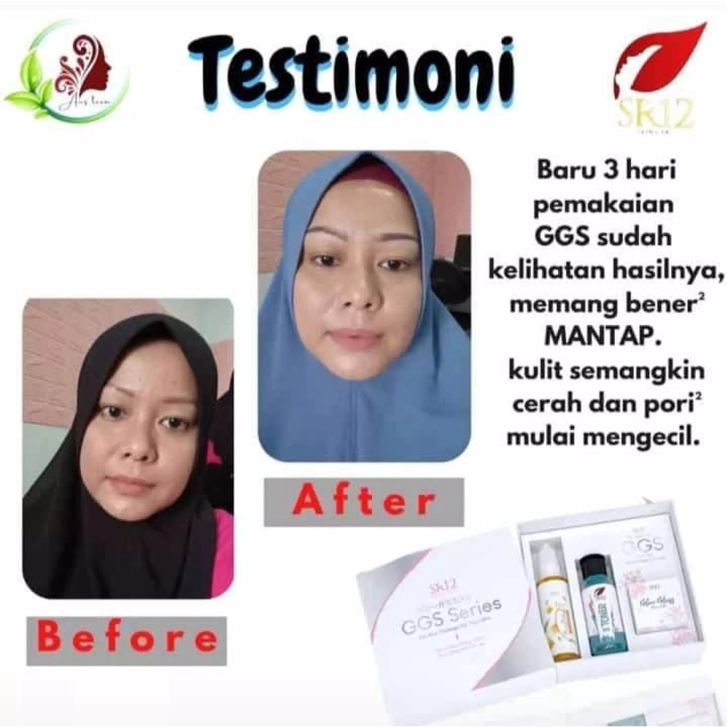 GGS SR12 | GGS Series SR12 Skincare | Glow Glass Skin Gel | Paket Perawatan &amp; Kecantikan