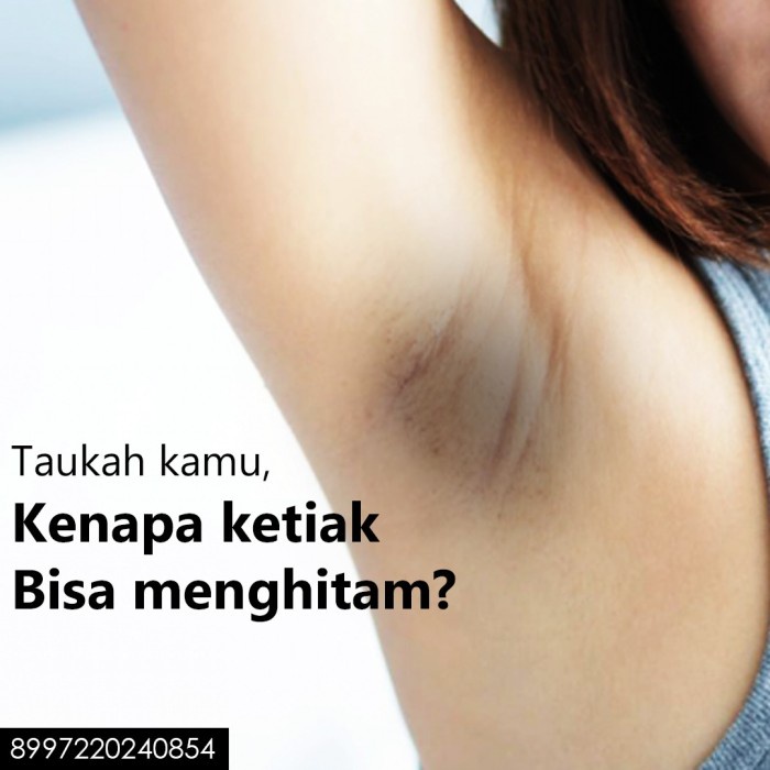 White lab WL Underarm Cream mencerahkan bagian dalammu